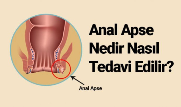 1 kadın 1 erkek kamera arkası filmlerde laf sokmalar