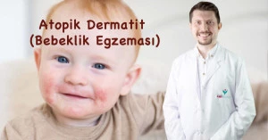 Atopik Dermatit (Bebeklik Egzeması) - Uzm. Dr. Murat Han Türker
