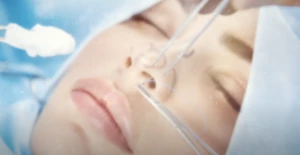 Burun Estetiğinde Çok Sorulan Sorular - Op.Dr. Ümit Karagöz