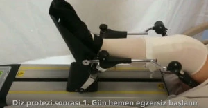 Diz protezi sonrası rahebilitasyon