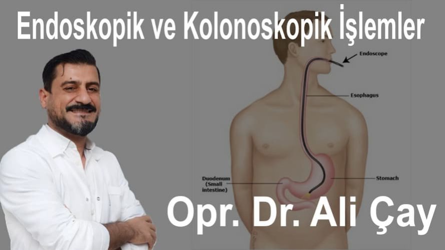 Endoskopik ve Kolonoskopik İşlemler - Op. Dr. Ali Çay