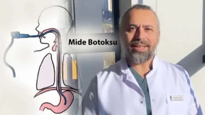 Mide Botoksu Nedir? Nasıl Uygulanır? - Opr. Dr. Doğan Fakıoğlu